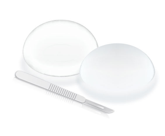 The breakdown of the cost for breast augmentation surgery reveals that most of the expense is for: surgeon's fee, anesthesia, breast implants and operating room fees.