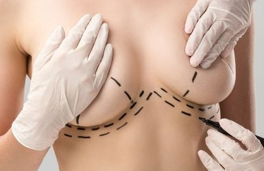 A person at a breast lift consultation has surgical guidelines marked on their skin by a gloved professional.