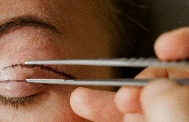 Closed eye with surgical markings; tweezers near eyelid for cosmetic surgery. Smooth skin