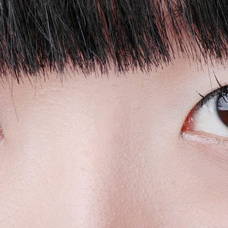 Close-up of eyes with eyelid tape