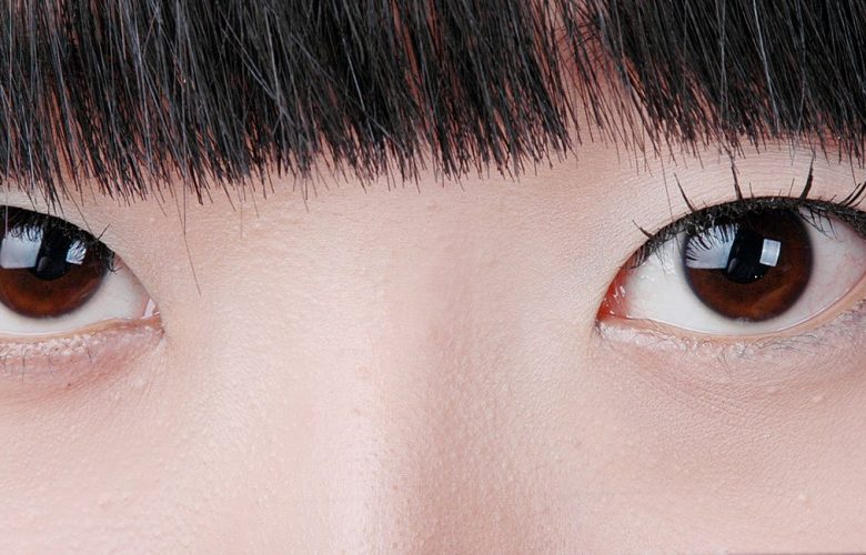 Close-up of eyes with eyelid tape