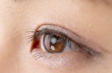 Close-up of an eye looking upward