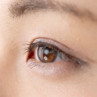 Close-up of an eye looking upward