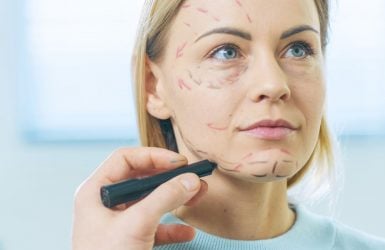 A calm blonde woman sits as surgical lines are drawn on her face