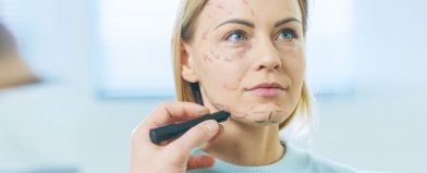 A calm blonde woman sits as surgical lines are drawn on her face