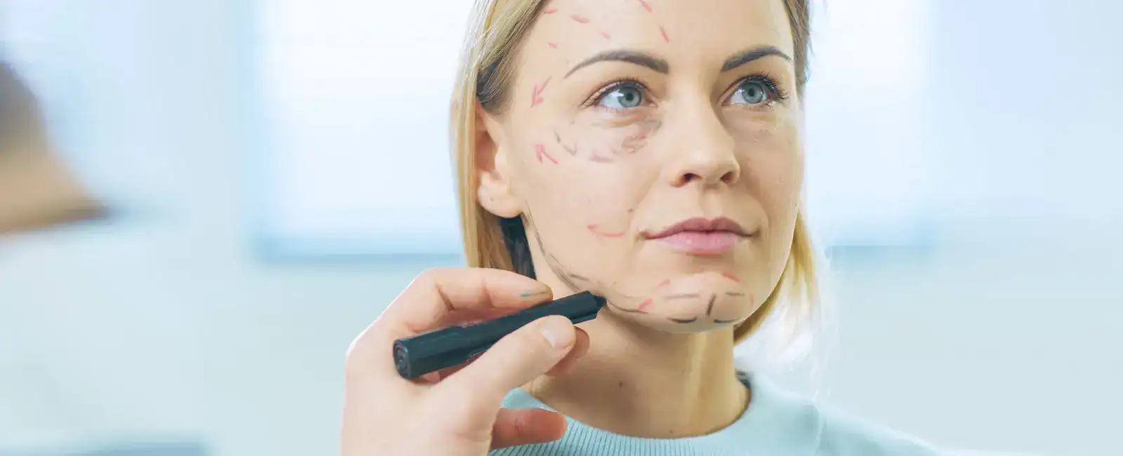 plastic-surgery-hawaii-hero-1 A calm blonde woman sits as surgical lines are drawn on her face