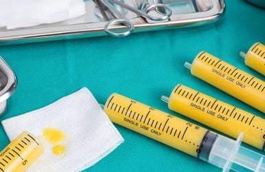 Fat transfer setup: syringes with fat