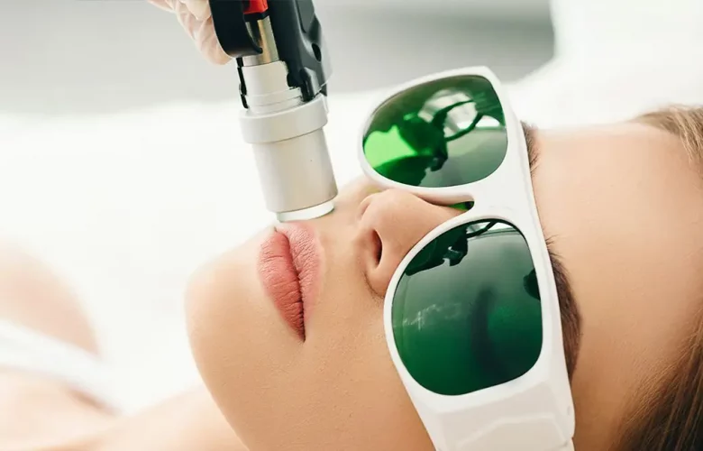Laser hair removal on upper lip; person wears goggles