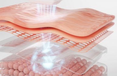Laser skin treatment targets skin layers to improve texture and appearance.
