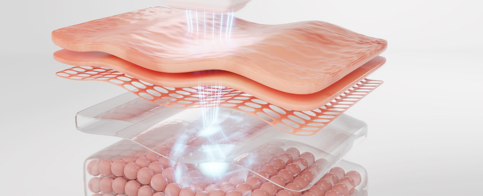 Laser skin treatment targets skin layers to improve texture and appearance.
