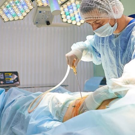 Surgeon performs liposuction on patient under bright lights