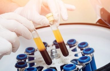 Gloved hands hold two yellow plasma test tubes above a centrifuge with multiple test tubes.