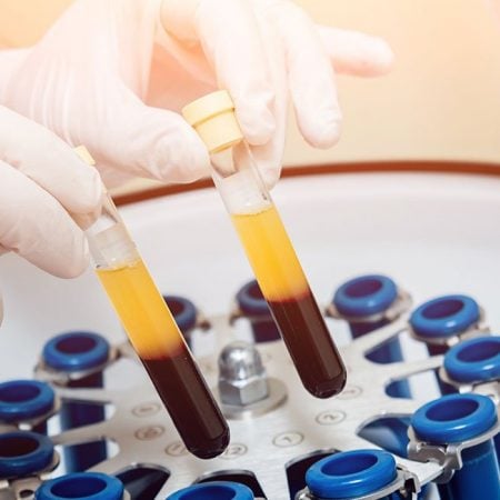 Gloved hands hold two yellow plasma test tubes above a centrifuge with multiple test tubes.