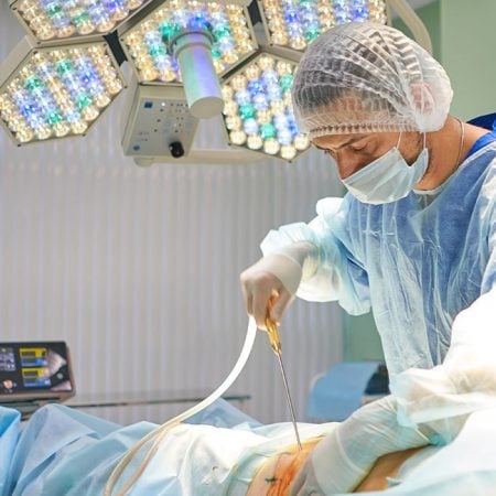 A plastic surgeon operates under surgical lights